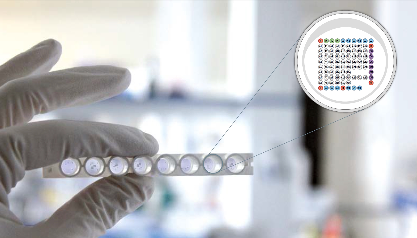 Understanding Autoimmune Diseases and InstaMed’s Advanced Testing Solution with Microblot Array Technology
